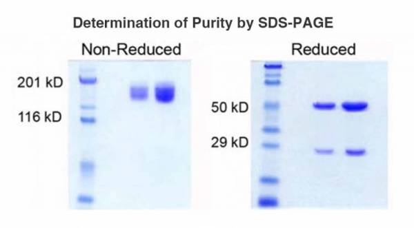 Determination of Purity SDS Page graph