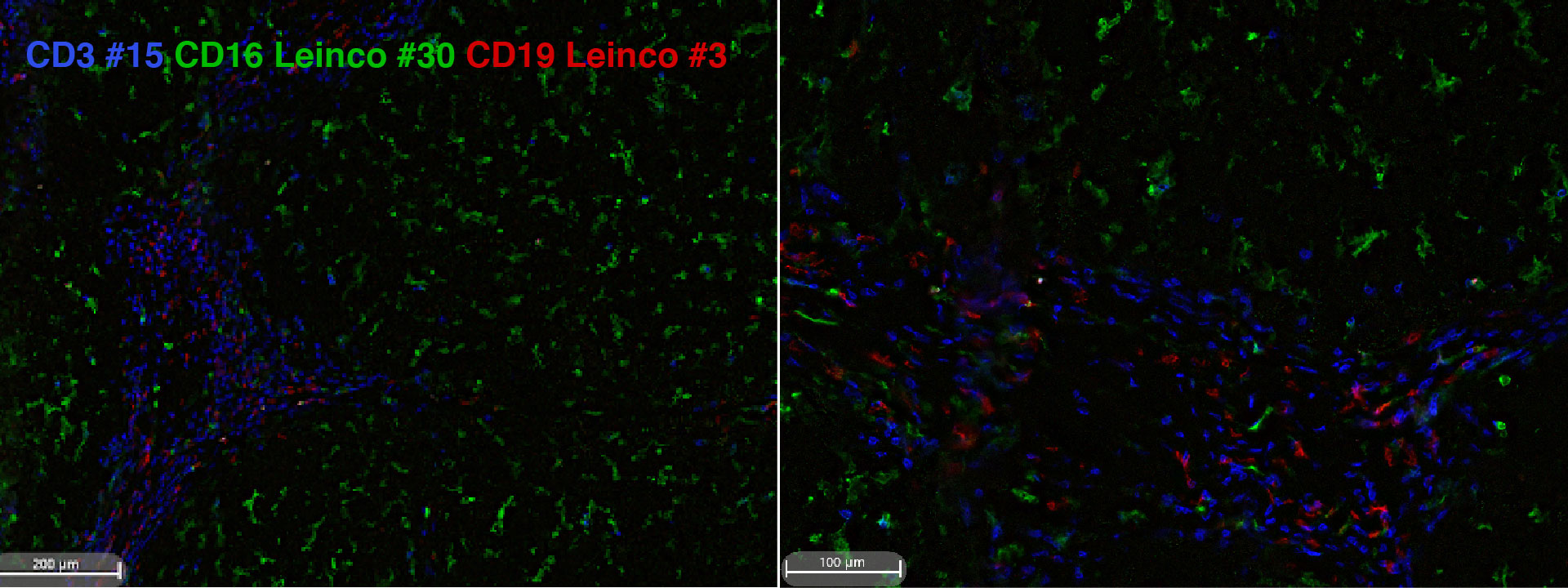 CD3-CD16-CD19-02 Banner Leinco's CD16 and CD18 - CODEX staining