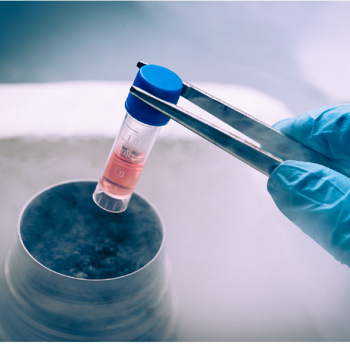 Cryo-09 Cells banking, liquid nytrogen tank