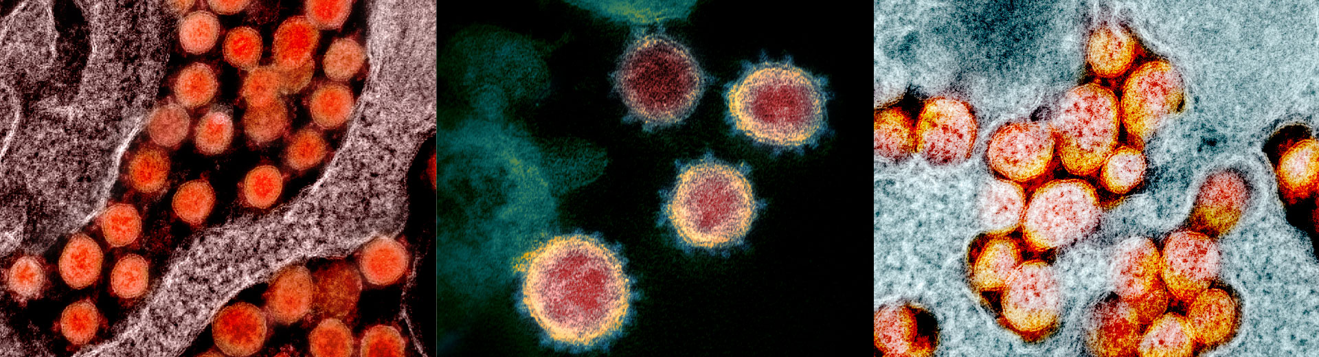 SARS CoV-2 home banner-01 SARS-CoV-2 virus up close. Antibodies and Antigens for COVID-19