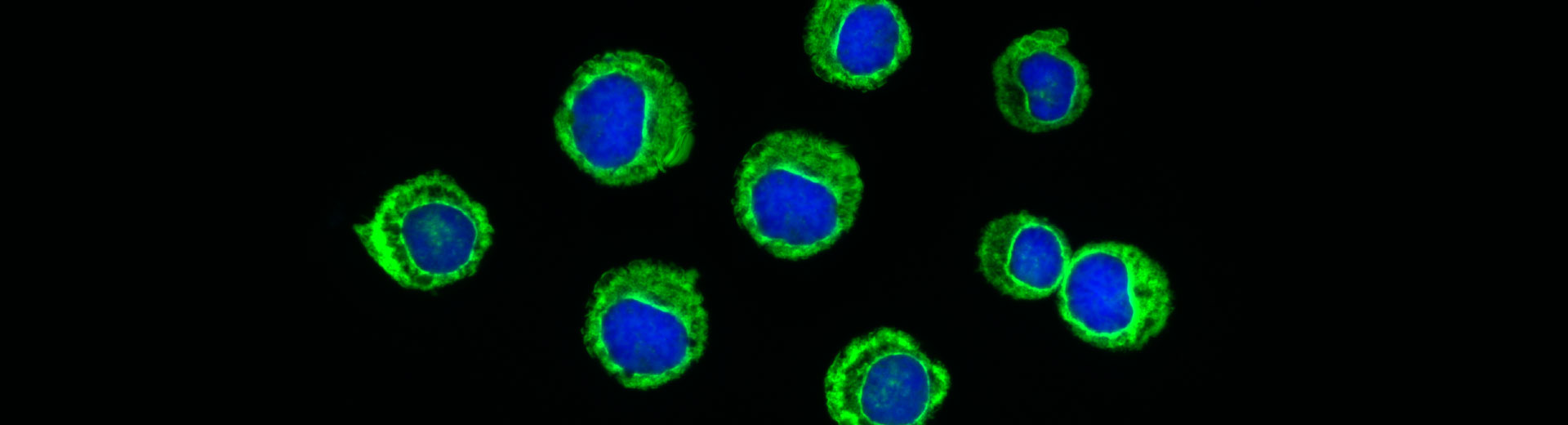 Leukemic cells conjugated in FITC - Dylight Fluorophores