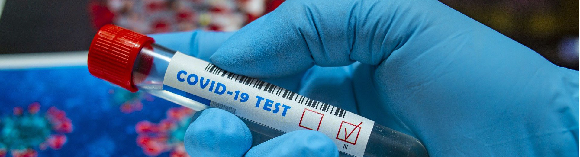 Covid19 research tools banner-02 Scientist holding COVID-19 Test tube