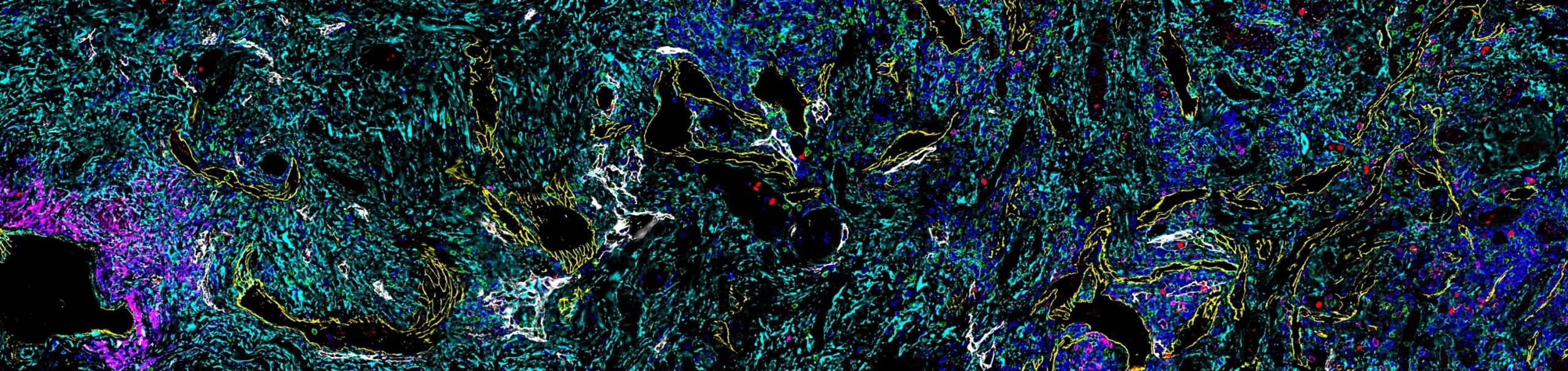 SpatialBiology-BlogTitle