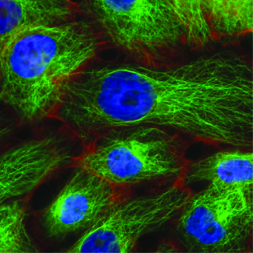 Immunofluorescence
