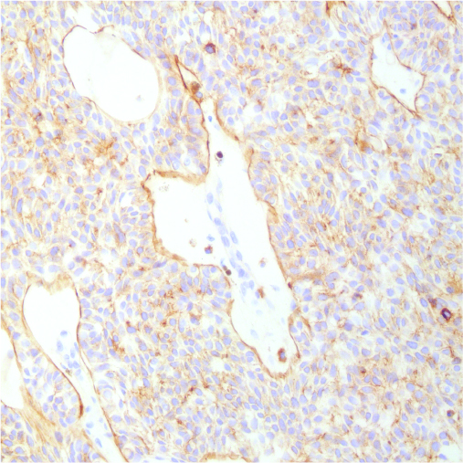 Immunohistochemistry