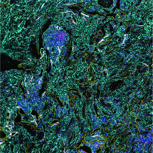Spatial Phenotyping