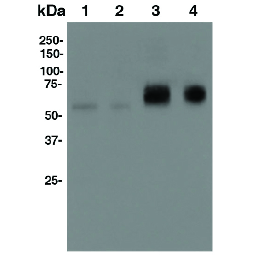 western blot western blot