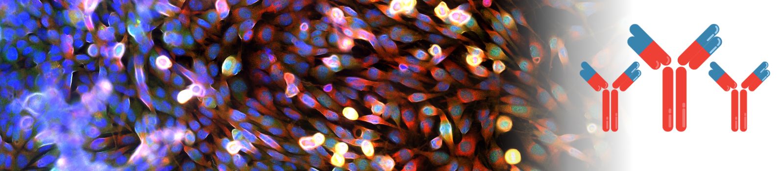 Chimeric Antibodies Banner Image Real fluorescence microscopic view of cancer cells - human brain