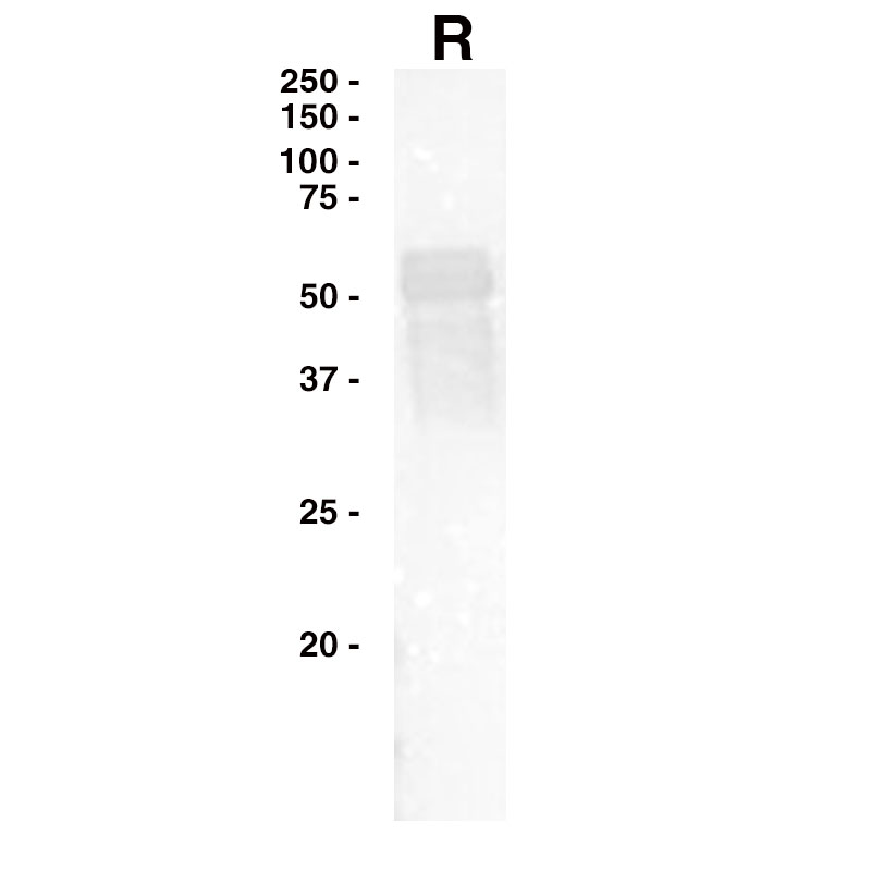 Western Blot Data for Influenza A NP Leinco Product Number F600