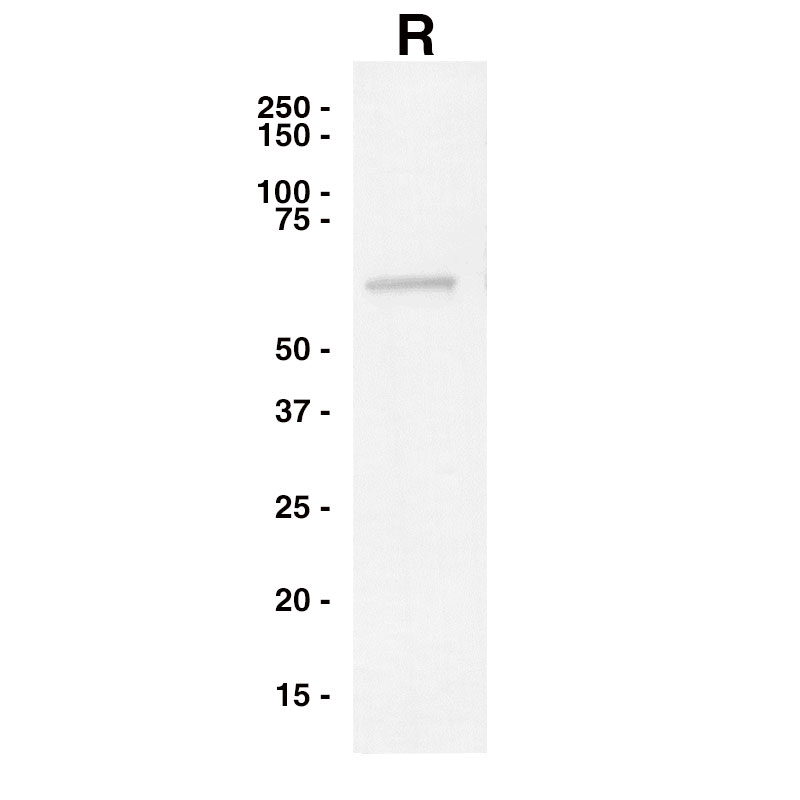 Western Blot data for Recombinant Influenza B Nucleocapsid Leinco Product F650