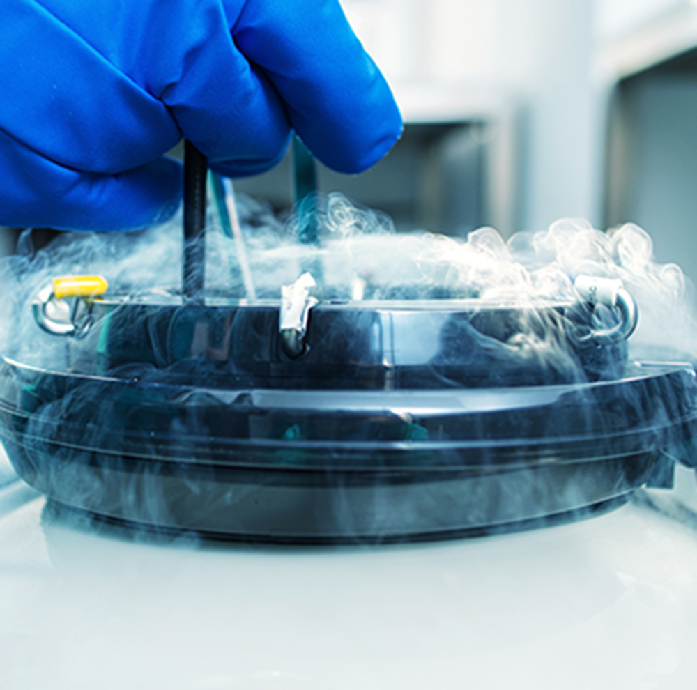 Liquid nitrogen cryogenic tank-cellbanking page Liquid nitrogen cryogenic tank