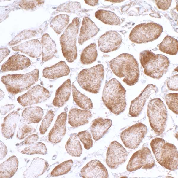 <b>Detection of human AMPK alpha 1 by immunohistochemistry.</b> <i>Sample:</i> FFPE section of human smooth muscle. <i>Antibody:</i> Affinity purified rabbit anti-AMPK alpha 1 (Cat. No. 13008 Lot 3) used at a dilution of 1:1|000 ( 1µg/ml). <i>Detection:</i> DAB|<b>Detection of human AMPK alpha 1 by western blot of immunoprecipitates.</b> <i>Samples:</i> Whole cell lysate (1.0 mg per IP reaction; 20% of IP loaded) from HeLa cells prepared using NETN lysis buffer. <i>Antibodies:</i> Affinity purified rabbit anti-AMPK alpha 1 antibody 13008 (lot 13008-3) used for IP at 3 µg per reaction. AMPK alpha 1 was also immunoprecipitated by a previous lot of this antibody (lot 13008-2). For blotting immunoprecipitated AMPK alpha 1