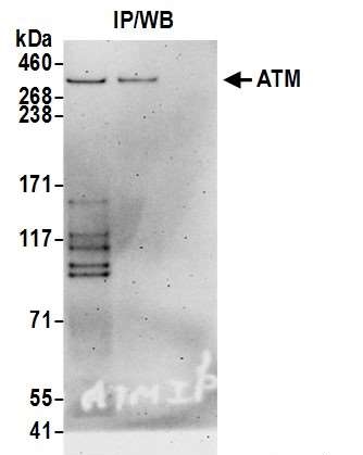 <b>Detection of human ATM by western blot of immunoprecipitates.</b> <i>Samples:</i> Whole cell lysate (1.0 mg per IP reaction; 20% of IP loaded) from HeLa cells prepared using NETN lysis buffer. <i>Antibodies:</i> Affinity purified goat anti-ATM antibody 13012 (lot 13012-2) used for IP at 3 µg per reaction. ATM was also immunoprecipitated by goat anti-ATM antibody 13014. For blotting immunoprecipitated ATM|13012 was used at 1 µg/ml. <i>Detection:</i> Chemiluminescence with an exposure time of 3 minutes.