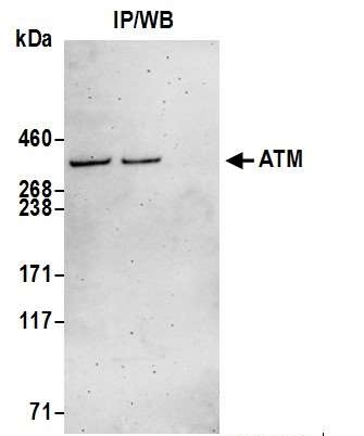 <b>Detection of human ATM by western blot of immunoprecipitates.</b> <i>Samples:</i> Whole cell lysate (1.0 mg per IP reaction; 20% of IP loaded) from HeLa cells prepared using NETN lysis buffer. <i>Antibodies:</i> Affinity purified goat anti-ATM antibody 13014 (lot 13014-2) used for IP at 3 µg per reaction. ATM was also immunoprecipitated by goat anti-ATM antibody 13012. For blotting immunoprecipitated ATM|13014 was used at 1 µg/ml. <i>Detection:</i> Chemiluminescence with an exposure time of 3 minutes.