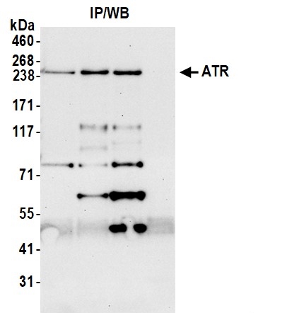 <b>Detection of human ATR by western blot of immunoprecipitates.</b> <i>Samples:</i> Whole cell lysate (1.0 mg per IP reaction; 20% of IP loaded) from HeLa cells prepared using NETN lysis buffer. <i>Antibodies:</i> Affinity purified rabbit anti-ATR antibody (13016 lot 3) used for IP at 6 µg per reaction. ATR was also immunoprecipitated by a previous lot of this antibody (13016 lot 2) and a second antibody against a different epitope of rabbit ATR (13018). For blotting immunoprecipitated ATR|13016 was used at 0.1 µg/ml. <i>Detection:</i> Chemiluminescence with an exposure time of 10 seconds.