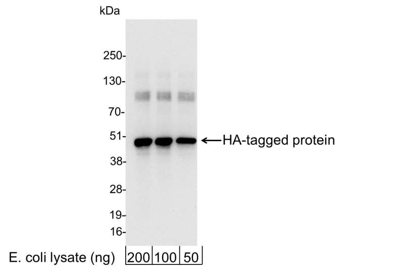 <b>Detection of HA-tagged Protein by western blot.</b> <i>Samples:</i> 200