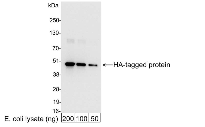 <b>Detection of HA-tagged Protein by western blot.</b> <i>Samples:</i> 200