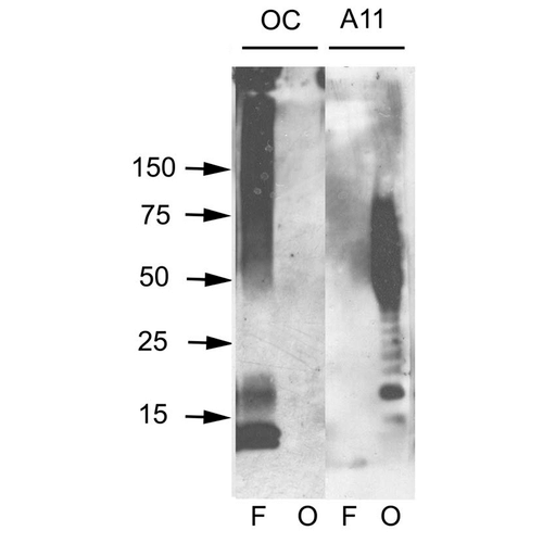 Western blot analysis of Human Abeta42 fibrils and prefibrillar oligomers showing detection of Amyloid Fibrils (OC) protein using Rabbit Anti-Amyloid Fibrils (OC) Polyclonal Antibody (57005). Primary Antibody: Rabbit Anti-Amyloid Fibrils (OC) Polyclonal Antibody (57005) at 1:1000. Courtesy of: Kayed, R., Head, E., Thompson, J. L., McIntire, T. M., Milton, S. C., Cotman, C. W., et al. (2003). Common structure of soluble amyloid oligomers implies common mechanism of pathogenesis. Science 300, 486–489. doi: 10.1126/science.1079469.