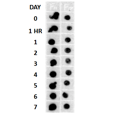 Description Dot blot analysis using Rabbit Anti-Amyloid Fibrils (OC) Polyclonal Antibody (57005). Tissue: Cell lysates. Species: Human. Primary Antibody: Rabbit Anti-Amyloid Fibrils (OC) Polyclonal Antibody (57005) at 1:500, 1:5000. Beta Amyloid HEPES-NaCl aggregation, showing 1:500 (L) and 1:5000 (R) time lapse dot blot.