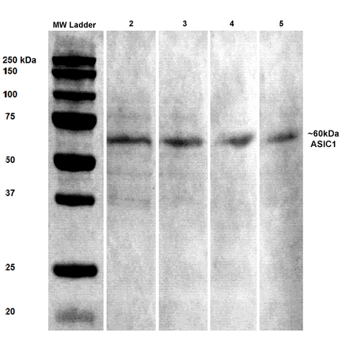 Western Blot analysis of Rat brain lysates showing detection of ASIC1 protein using Mouse Anti-ASIC1 Monoclonal Antibody, Clone S271-44 (11573). Primary Antibody: Mouse Anti-ASIC1 Monoclonal Antibody (11573) at 1:100, 1:250, 1:500, and 1:1000.