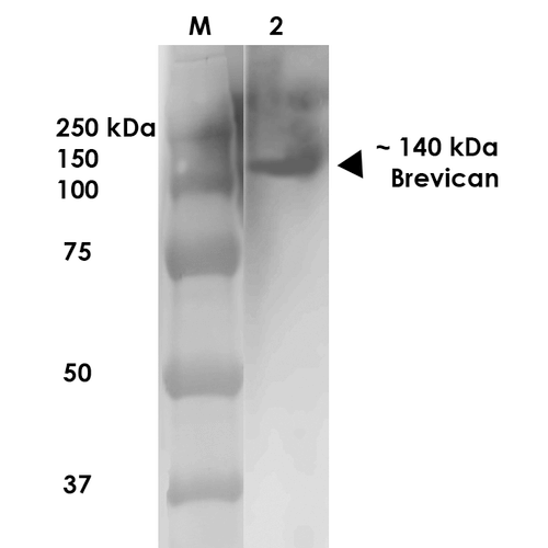 Western Blot analysis of Rat Brain Membrane showing detection of ~140 kDa Brevican protein using Mouse Anti-Brevican Monoclonal Antibody, Clone S294A-6 (56541). Lane 1: MW Ladder. Lane 2: Rat Brain Membrane (10 µg). . Load: 10 µg. Block: 5% milk. Primary Antibody: Mouse Anti-Brevican Monoclonal Antibody (56541) at 1:1000 for 1 hour at RT. Secondary Antibody: Goat Anti-Mouse IgG: HRP at 1:200 for 1 hour at RT. Color Development: TMB solution for 10 min at RT. Predicted/Observed Size: ~140 kDa.