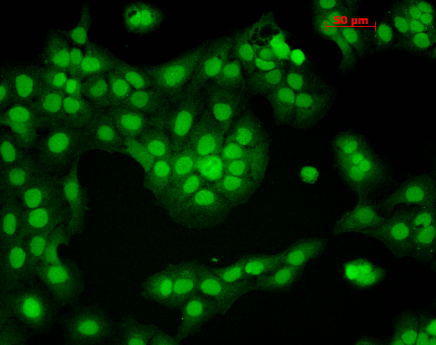 Immunocytochemistry/Immunofluorescence analysis using Mouse Anti-CaMKII Monoclonal Antibody, Clone 6G9 (56453). Tissue: HaCaT cells. Species: Human. Fixation: Cold 100% methanol for 10 minutes at -20°C. Primary Antibody: Mouse Anti-CaMKII Monoclonal Antibody (56453) at 1:100 for 1 hour at RT. Secondary Antibody: FITC Goat Anti-Mouse (green) at 1:50 for 1 hour at RT. Localization: Nuclear Staining.