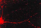 Immunocytochemistry/Immunofluorescence analysis using Mouse Anti-CaMKII Monoclonal Antibody, Clone 6G9 (56453). Tissue: dissociated hippocampal neurons. Species: Mouse. Fixation: Cold 4% paraformaldehyde/0.2% glutaraldehyde in 0.1M sodium phosphate buffer. Primary Antibody: Mouse Anti-CaMKII Monoclonal Antibody (56453) at 1:1000 for 12 hours at 4°C. Secondary Antibody: FITC Goat Anti-Mouse IgG (green) at 1:50 for 30 minutes at RT. Magnification: 10X. Courtesy of: Mary Kennedy, Caltech.