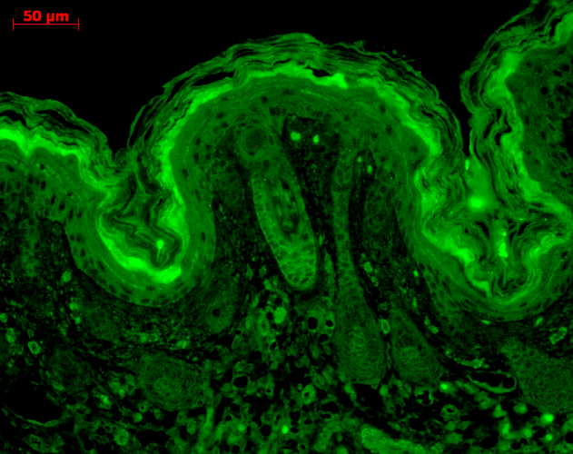 Immunohistochemistry analysis using Mouse Anti-CaMKII Monoclonal Antibody, Clone 6G9 (56453). Tissue: backskin. Species: Mouse. Fixation: Bouin
