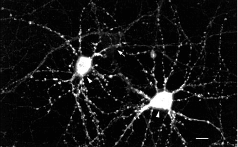 Immunocytochemistry/Immunofluorescence analysis using Mouse Anti-CaMKII Monoclonal Antibody, Clone 22B1 (56454). Tissue: dissociated hippocampal neurons. Species: Rat. Fixation: Cold 4% paraformaldehyde/0.2% glutaraldehyde in 0.1M sodium phosphate buffer. Primary Antibody: Mouse Anti-CaMKII Monoclonal Antibody (56454) at 1:1000 for 12 hours at 4°C. Secondary Antibody: FITC Goat Anti-Mouse IgG (green) at 1:50 for 30 minutes at RT. Magnification: 10X. Courtesy of: Mary Kennedy, Caltech.