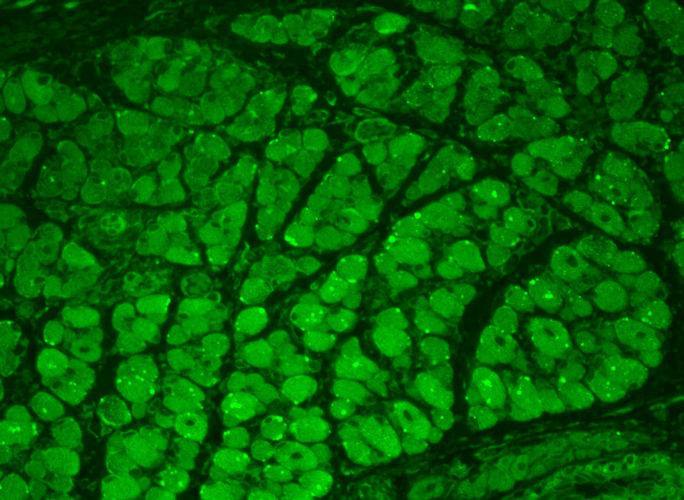 Immunohistochemistry analysis using Mouse Anti-CaMKII Monoclonal Antibody, Clone 22B1 (56454). Tissue: backskin. Species: Mouse. Fixation: Bouin