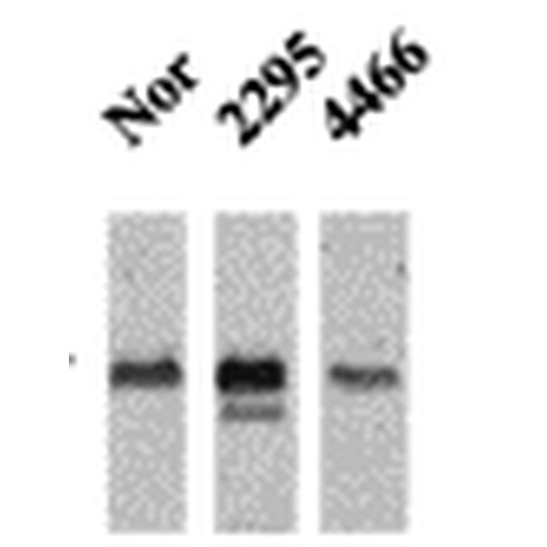 Western Blot analysis of Mouse Ventricle lysates showing detection of CaMKII protein using Mouse Anti-CaMKII Monoclonal Antibody, Clone 22B1 (56454). Primary Antibody: Mouse Anti-CaMKII Monoclonal Antibody (56454) at 1:1000. Analysis of CaMKII and NFAT phosphorylation in ventricles of 14 day old mice over-expressing CaMK.