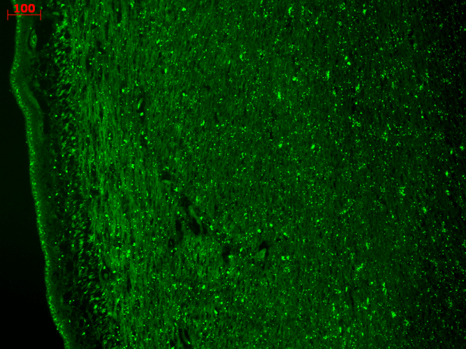 Immunohistochemistry analysis using Mouse Anti-CaV3.2 Calcium Channel Monoclonal Antibody, Clone N55/10 (11505). Tissue: hippocampus. Species: Human. Fixation: Bouin