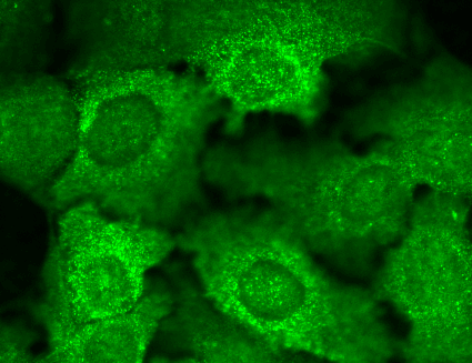 Immunocytochemistry/Immunofluorescence analysis using Mouse Anti-Cav Beta2 Calcium Channel Monoclonal Antibody, Clone S8b-1 (11524). Tissue: HaCaT cells. Species: Human. Fixation: Cold 100% methanol for 10 minutes at -20°C. Primary Antibody: Mouse Anti-Cav Beta2 Calcium Channel Monoclonal Antibody (11524) at 1:100 for 1 hour at RT. Secondary Antibody: FITC Goat Anti-Mouse (green) at 1:50 for 1 hour at RT. Localization: All cells positive. Bright dottiness located throughout cytoplasm and in nuclei.