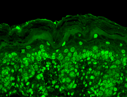 Immunohistochemistry analysis using Mouse Anti-Cav Beta2 Calcium Channel Monoclonal Antibody, Clone S8b-1 (11524). Tissue: backskin. Species: Mouse. Fixation: Bouin