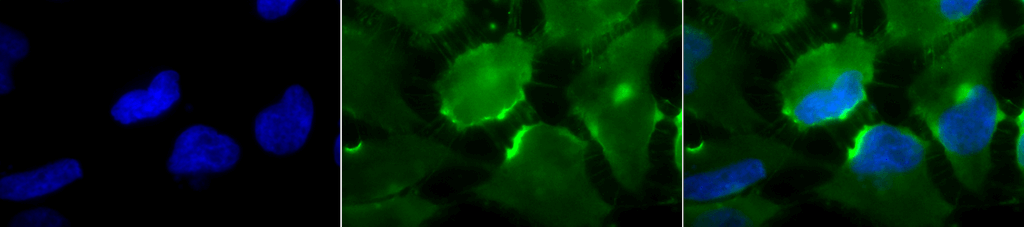 Immunocytochemistry/Immunofluorescence analysis using Mouse Anti-CD74 Monoclonal Antibody, Clone PIN 1.1 (56451). Tissue: Cervical cancer cell line (HeLa). Species: Human. Fixation: 2% Formaldehyde for 20 min at RT. Primary Antibody: Mouse Anti-CD74 Monoclonal Antibody (56451) at 1:100 for 12 hours at 4°C. Secondary Antibody: FITC Goat Anti-Mouse (green) at 1:200 for 2 hours at RT. Counterstain: DAPI (blue) nuclear stain at 1:40000 for 2 hours at RT. Localization: Cell membrane. Endoplasmic reticulum membrane. Golgi apparatus. Endosome. Lysosome. Magnification: 100x. (A) DAPI (blue) nuclear stain. (B) Anti-CD74 Antibody. (C) Composite.