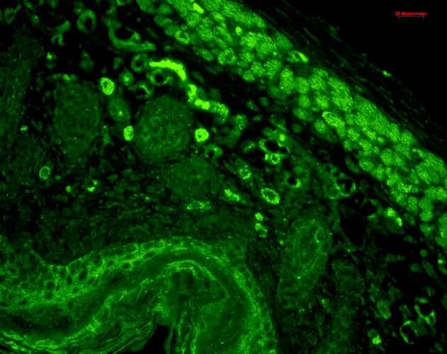 Immunohistochemistry analysis using Mouse Anti-CD74 Monoclonal Antibody, Clone PIN 1.1 (56451). Tissue: backskin. Species: Mouse. Fixation: Bouin