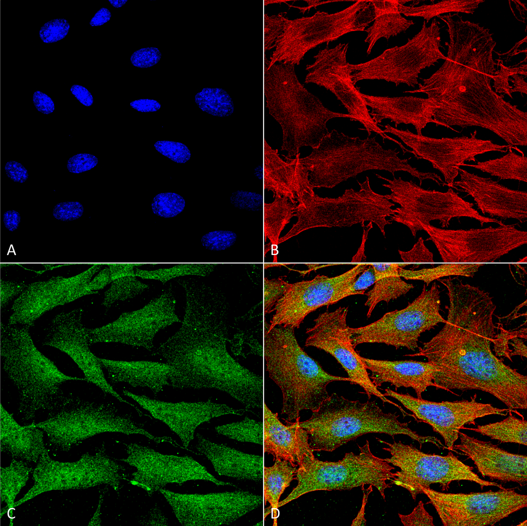 Immunocytochemistry/Immunofluorescence analysis using Mouse Anti-Copper Transporting ATPase 1 Monoclonal Antibody, Clone S60-4 (56516). Tissue: NIH 3T3 (NIH 3T3). Species: Mouse. Fixation: 4% Formaldehyde for 15 min at RT. Primary Antibody: Mouse Anti-Copper Transporting ATPase 1 Monoclonal Antibody (56516) at 1:100 for 60 min at RT. Secondary Antibody: Goat Anti-Mouse ATTO 488 at 1:200 for 60 min at RT. Counterstain: Phalloidin Texas Red F-Actin stain; DAPI (blue) nuclear stain at 1:1000, 1:5000 for 60 min at RT, 5 min at RT. Localization: Endoplasmic Reticulum, Cytoplasm, Golgi Apparatus, Trans-Golgi Network Membrane, Cell Membrane. Magnification: 60X. (A) DAPI (blue) nuclear stain. (B) Phalloidin Texas Red F-Actin stain. (C) Copper Transporting ATPase 1 Antibody. (D) Composite.