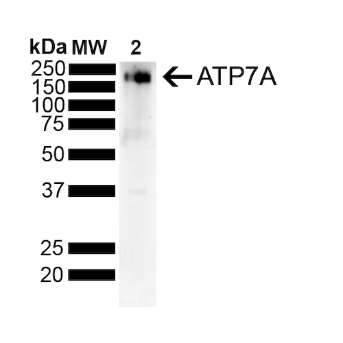 Western Blot analysis of Rat Liver showing detection of ~180 kDa Copper Transporting ATPase 1 protein using Mouse Anti-Copper Transporting ATPase 1 Monoclonal Antibody, Clone S60-4 (56516). Lane 1: MW Ladder. Lane 2: Rat Liver . Load: 10 ug. Block: 5% Skim Milk powder in TBST. Primary Antibody: Mouse Anti-Copper Transporting ATPase 1 Monoclonal Antibody (56516) at 1:500 for 2 hours at RT with shaking. Secondary Antibody: Goat anti-mouse IgG:HRP at 1:4000 for 1 hour at RT with shaking. Color Development: Chemiluminescent for HRP (Moss) for 5 min in RT. Predicted/Observed Size: ~180 kDa.