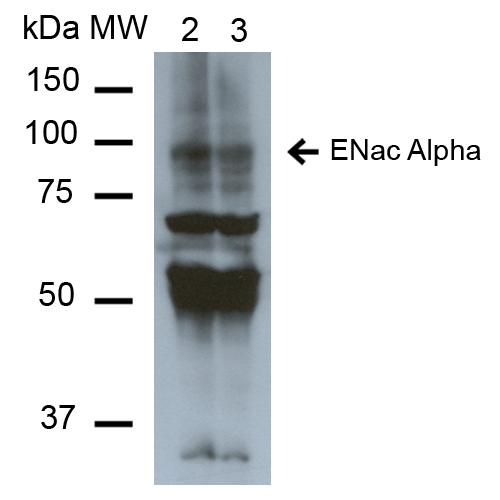 Western Blot analysis of Mouse Whole kidney homogenates showing detection of ~85kDa ENaC alpha protein using Mouse Anti-ENaC alpha Monoclonal Antibody, Clone 2G4 (11575). Lane 1: Molecular Weight Ladder (MW). Lane 2: Low-salt diet. Lane 3: Normal-salt diet. Load: 20 µg. Primary Antibody: Mouse Anti-ENaC alpha Monoclonal Antibody (11575) at 1:1000. Predicted/Observed Size: ~85kDa.