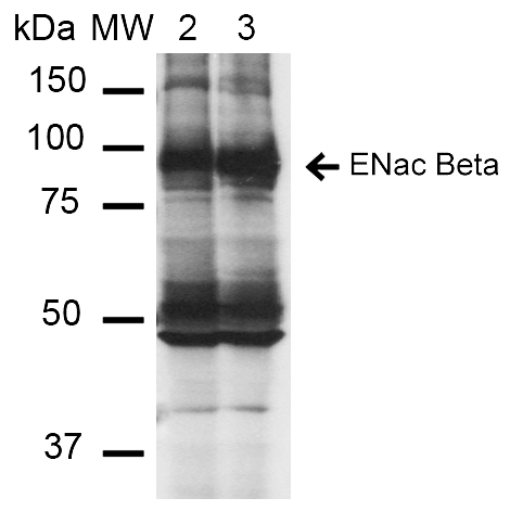 Western Blot analysis of Mouse Whole kidney homogenates showing detection of ~87kDa ENaC beta protein using Mouse Anti-ENaC beta Monoclonal Antibody, Clone 16E4 (11576). Lane 1: Molecular Weight Ladder (MW). Lane 2: Low-salt diet. Lane 3: Normal-salt diet. Load: 20 µg. Primary Antibody: Mouse Anti-ENaC beta Monoclonal Antibody (11576) at 1:1000. Predicted/Observed Size: ~87kDa.