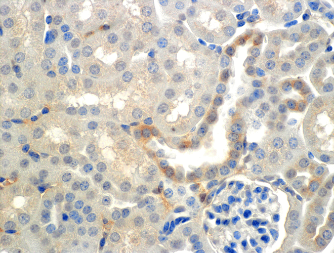 Immunohistochemistry analysis using Mouse Anti-ENaC beta Monoclonal Antibody, Clone 7B8 (11577). Tissue: Kidney (cortex). Species: Mouse. Primary Antibody: Mouse Anti-ENaC beta Monoclonal Antibody (11577) at 1:150. Localization: Collecting duct principal cells. Magnification: 60X.
