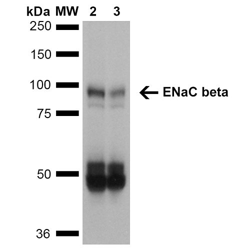 Western Blot analysis of Mouse Whole kidney homogenates showing detection of ~87kDa ENaC beta protein using Mouse Anti-ENaC beta Monoclonal Antibody, Clone 7B8 (11577). Lane 1: Molecular Weight Ladder (MW). Lane 2: Low-salt diet. Lane 3: Normal-salt diet. Load: 20 µg. Primary Antibody: Mouse Anti-ENaC beta Monoclonal Antibody (11577) at 1:1000. Predicted/Observed Size: ~87kDa.