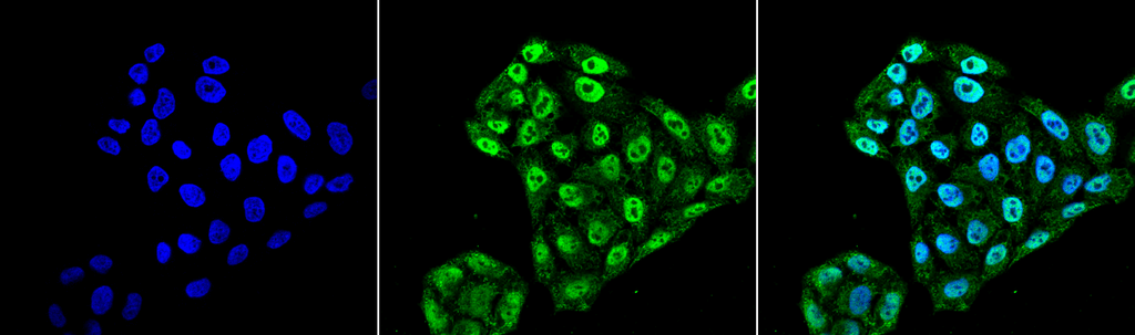 Immunocytochemistry/Immunofluorescence analysis using Mouse Anti-EndoPDI Monoclonal Antibody, Clone 2E7/7 (56458). Tissue: Cervical cancer cell line (HeLa). Species: Human. Fixation: 4% Formaldehyde for 15 min at RT. Primary Antibody: Mouse Anti-EndoPDI Monoclonal Antibody (56458) at 1:100 for 60 min at RT. Secondary Antibody: Goat Anti-Mouse ATTO 488 at 1:100 for 60 min at RT. Counterstain: DAPI (blue) nuclear stain at 1:5000 for 5 min RT. Localization: Nucleus, Endoplasmic Reticulum, Endoplasmic Reticulum Lumen. Magnification: 60X.
