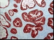 Immunohistochemistry analysis using Mouse Anti-FKBP52 Monoclonal Antibody, Clone Hi52C (11103). Tissue: prostate tissue (ductal epithelial cells). Species: Human. Primary Antibody: Mouse Anti-FKBP52 Monoclonal Antibody (11103) at 1:1000. Courtesy of: David F. Smith, Mayo Clinic, USA.