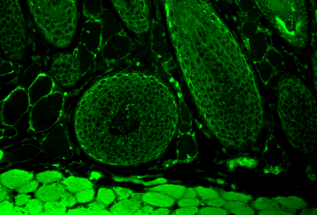 Immunohistochemistry analysis using Mouse Anti-FKBP52 Monoclonal Antibody, Clone Hi52C (11103). Tissue: backskin. Species: Mouse. Fixation: Bouin