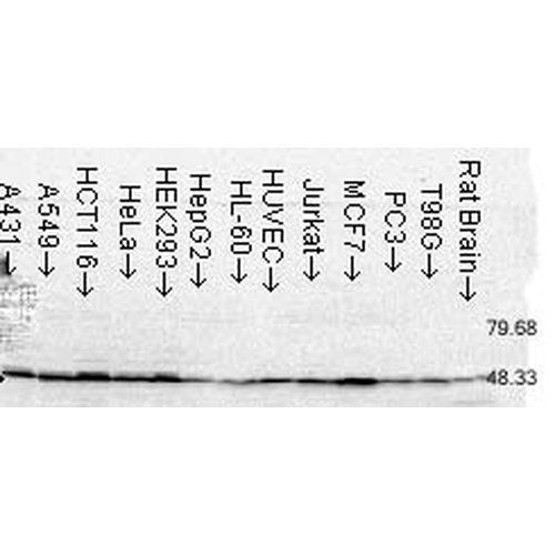 Western Blot analysis of Human Cell lysates showing detection of FKBP52 protein using Mouse Anti-FKBP52 Monoclonal Antibody, Clone Hi52C (11103). Load: 15 µg. Block: 1.5% BSA for 30 minutes at RT. Primary Antibody: Mouse Anti-FKBP52 Monoclonal Antibody (11103) at 1.5 µg/mL for 2 hours at RT. Secondary Antibody: Sheep Anti-Mouse IgG: HRP for 1 hour at RT.