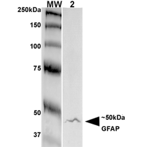 Western Blot analysis of Rat Brain Membrane showing detection of GFAP protein using Mouse Anti-GFAP Monoclonal Antibody, Clone S206A-8 (56566). Primary Antibody: Mouse Anti-GFAP Monoclonal Antibody (56566) at 1:250.