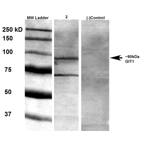 Western Blot analysis of Rat brain membrane lysate showing detection of GIT1 protein using Mouse Anti-GIT1 Monoclonal Antibody, Clone S39B-8 (56537). Primary Antibody: Mouse Anti-GIT1 Monoclonal Antibody (56537) at 1:1000.
