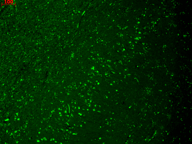 Immunohistochemistry analysis using Mouse Anti-HCN4 Monoclonal Antibody, Clone N114/10 (11509). Tissue: hippocampus. Species: Human. Fixation: Bouin
