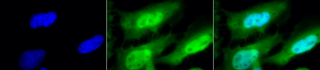 Immunocytochemistry/Immunofluorescence analysis using Rat Anti-HSF1 Monoclonal Antibody, Clone 10H8 (12518). Tissue: Heat Shocked cervical cancer cells (HeLa). Species: Human. Fixation: 2% Formaldehyde for 20 min at RT. Primary Antibody: Rat Anti-HSF1 Monoclonal Antibody (12518) at 1:100 for 12 hours at 4°C. Secondary Antibody: FITC Goat Anti-Rat (green) at 1:200 for 2 hours at RT. Counterstain: DAPI (blue) nuclear stain at 1:40000 for 2 hours at RT. Localization: Diffuse nuclear and cytoplasmic staining. Magnification: 100x. (A) DAPI (blue) nuclear stain. (B) Anti-HSF1 Antibody. (C) Composite. Heat Shocked at 42°C for 1h.